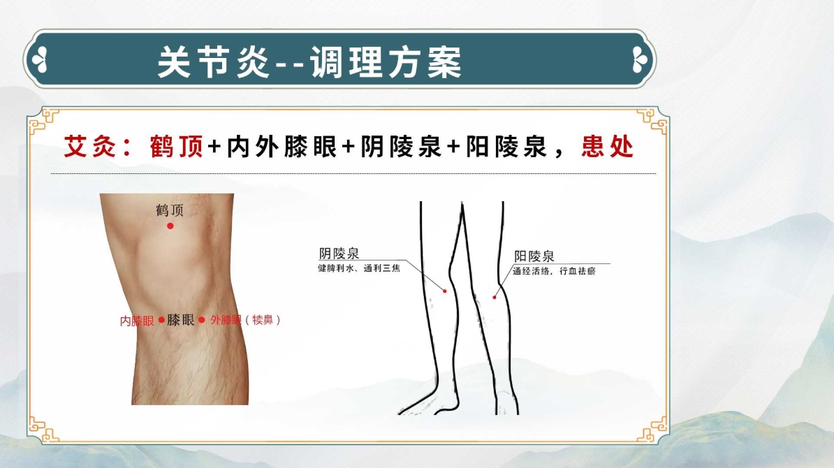 生命全息手诊——关节炎诊断方法(附调理方案)! 生命全息手诊——关节炎诊断方法(附调理方案)!