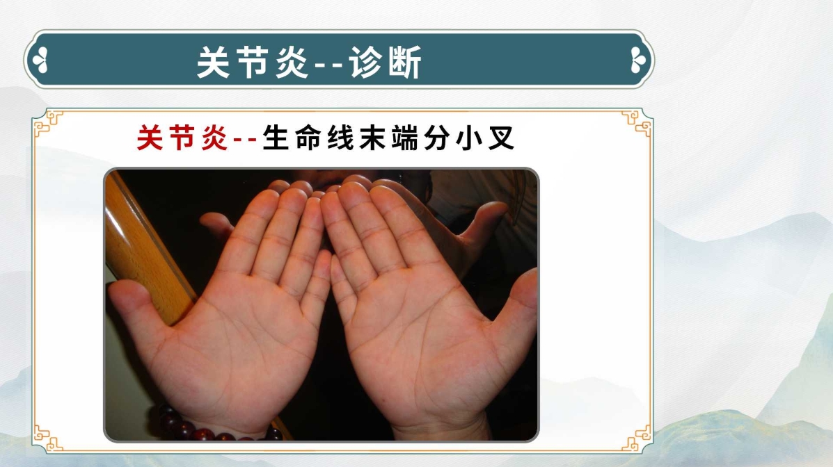 生命全息手诊——关节炎诊断方法(附调理方案)! 生命全息手诊——关节炎诊断方法(附调理方案)!