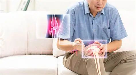 世界关节炎日 | 关节炎不是老人专属,关爱关节从你我做起|关节炎|饮食|尿酸|症状|-健康界