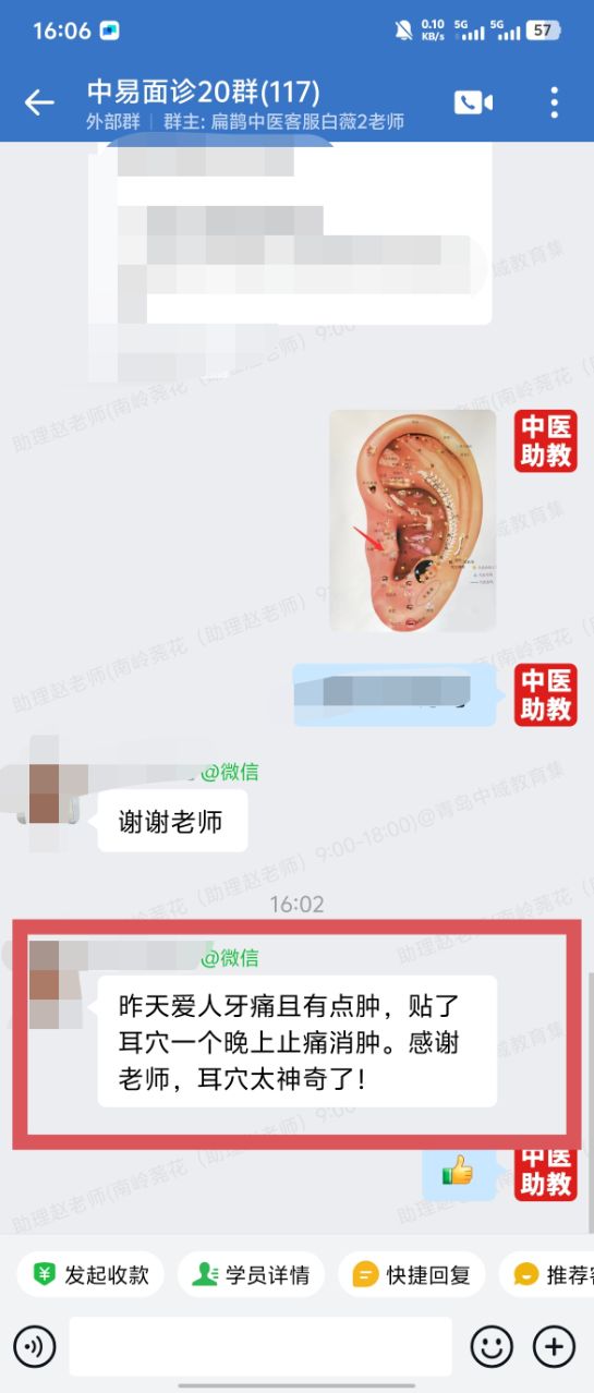 中易面诊学员反馈：牙痛且有点肿，贴了耳穴，一晚上止痛消肿！