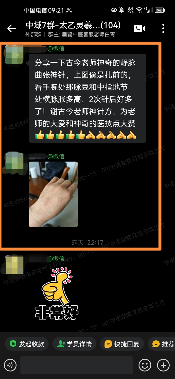 太乙灵羲术学员反馈：手腕处静脉曲张，用太乙针灸2次后改善很多！
