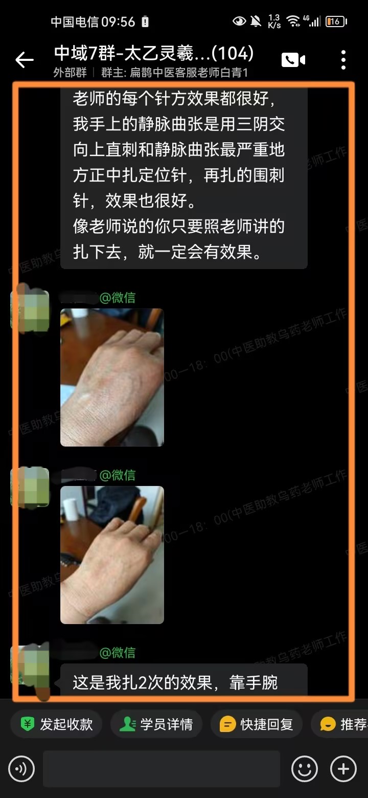 太乙灵羲术学员反馈:运用古今老师针方,静脉曲张明显好转! 太乙灵羲术学员反馈:运用古今老师针方,静脉曲张明显好转!