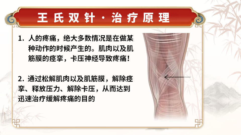 王氏实战双针术的调理理论是什么? 王氏实战双针术的调理理论是什么?